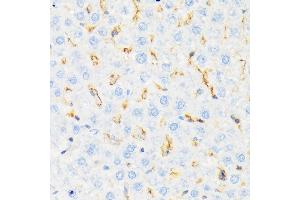 Immunohistochemistry of paraffin-embedded rat liver using CSK Rabbit mAb (ABIN1513217, ABIN3021034, ABIN3021035 and ABIN7101334) at dilution of 1:100 (40x lens). (CSK antibody)