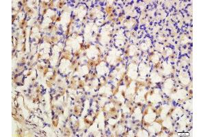 Formalin-fixed and paraffin embedded rat stomach labeled with Anti-SCN7A Polyclonal Antibody, Unconjugated  at 1:200 followed by conjugation to the secondary antibody and DAB staining. (SCN7A antibody  (AA 1561-1582))