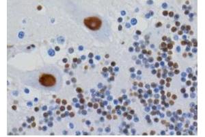 Image no. 2 for anti-Heterogeneous Nuclear Ribonucleoprotein U (Scaffold Attachment Factor A) (HNRNPU) antibody (ABIN108577) (HNRNPU antibody)
