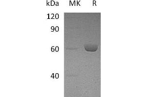 Western Blotting (WB) image for Carboxylesterase 2E (CES2E) protein (His tag) (ABIN7320480) (Carboxylesterase 2E (CES2E) protein (His tag))