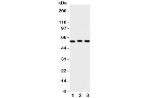 Western blot testing of PKM2 antibody and Lane 1:  HeLa;  2: MCF-7;  3: A549 cell lysate (PKM2 antibody  (N-Term))