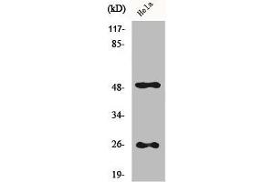 Western Blot analysis of Hela cells using Clusterin Polyclonal Antibody (Clusterin antibody  (C-Term))