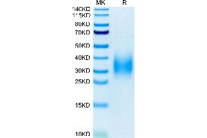Human TREM2 on Tris-Bis PAGE under reduced condition.
