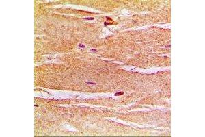 Immunohistochemical analysis of Frataxin staining in rat heart formalin fixed paraffin embedded tissue section. (Frataxin antibody)
