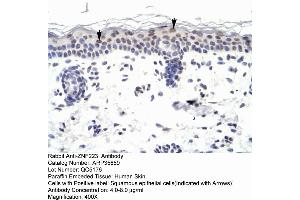 Human Skin (ZNF223 antibody  (N-Term))