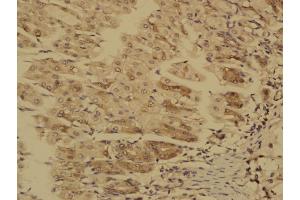 Paraformaldehyde-fixed, paraffin embedded Mouse stomach; Antigen retrieval by boiling in sodium citrate buffer (pH6. (MTM1 antibody  (AA 225-275))