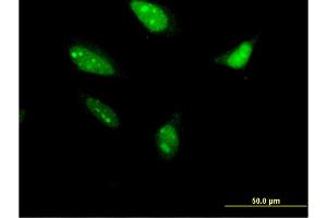 Immunofluorescence of monoclonal antibody to RNF212 on HeLa cell. (RNF212 antibody  (AA 133-232))