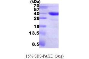SDS-PAGE (SDS) image for Aspartoacylase (ASPA) (AA 1-313) protein (His tag) (ABIN668026)