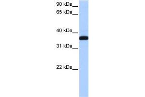 WB Suggested Anti-THEX1 Antibody Titration: 0. (ERI1 antibody  (N-Term))