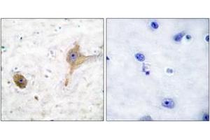 Immunohistochemistry (IHC) image for anti-gamma-aminobutyric Acid (GABA) B Receptor, 1 (GABBR1) (AA 871-920) antibody (ABIN1533279)