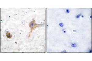 Immunohistochemistry analysis of paraffin-embedded human brain tissue, using GABA-B Receptor Antibody. (GABBR1 antibody  (AA 871-920))
