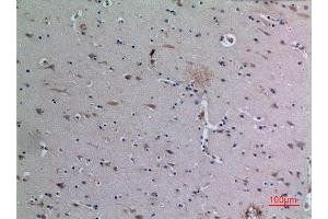 Immunohistochemistry (IHC) analysis of paraffin-embedded Human Brain, antibody was diluted at 1:100. (DPP7 antibody  (C-Term))