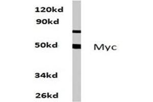 Image no. 1 for anti-Myc Proto-Oncogene protein (MYC) antibody (ABIN271737) (c-MYC antibody)