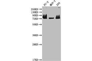 Western Blot Positive WB detected in: PC-3 whole cell lysate, MCF-7 whole cell lysate, 293 whole cell lysate All lanes: MEN1 antibody at 1:2000 Secondary Goat polyclonal to rabbit IgG at 1/50000 dilution Predicted band size: 69, 68, 64 kDa Observed band size: 75 kDa (Recombinant Menin antibody)