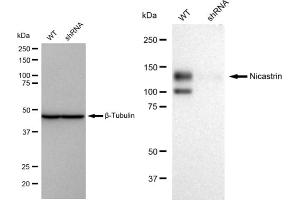 Western blotting analysis using Nicastrin antibody (ABIN7799593). (Recombinant Nicastrin antibody)