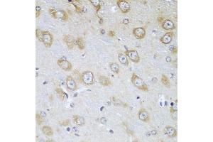 Immunohistochemistry of paraffin-embedded mouse brain using TMOD3 antibody at dilution of 1:100 (40x lens).