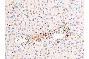 ABIN6256552 and ABIN6267251 at 1/100 staining rat liver tissue sections by IHC-P.