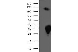 HEK293T cells were transfected with the pCMV6-ENTRY control (Left lane) or pCMV6-ENTRY PGAM2 (Right lane) cDNA for 48 hrs and lysed. (PGAM2 antibody)