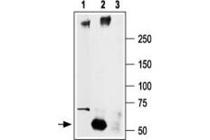 Immunoprecipitation of rat brain lysate: - 1. (SCN2A antibody  (Intracellular))