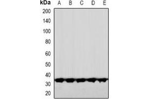 Western blot analysis of CNOT7 expression in HeLa (A), HuvEc (B), DKD (C), mouse brain (D), rat brain (E) whole cell lysates. (CNOT7 antibody  (N-Term))
