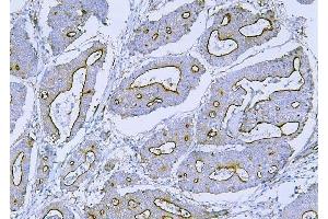 IHC analysis of Filamin B/FLNB using anti-Filamin B/FLNB antibody (ABIN7601607). (FLNB antibody  (AA 397-701))