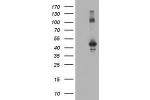 HEK293T cells were transfected with the pCMV6-ENTRY control (Left lane) or pCMV6-ENTRY CCM2 (Right lane) cDNA for 48 hrs and lysed. (CCM2 antibody)