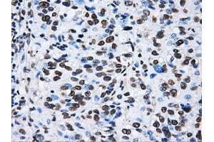 Image no. 15 for anti-ATP Synthase, H+ Transporting, Mitochondrial F1 Complex, beta Polypeptide (ATP5B) antibody (ABIN1496766) (ATP5B antibody)