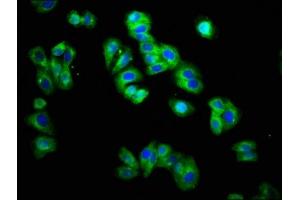 Immunofluorescence staining of HepG2 cells with ABIN7172182 at 1:166, counter-stained with DAPI. (TRHR antibody  (AA 320-398))