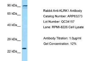 Western Blotting (WB) image for anti-Killer Cell Lectin-Like Receptor Subfamily K, Member 1 (KLRK1) (C-Term) antibody (ABIN2789431) (KLRK1 antibody  (C-Term))