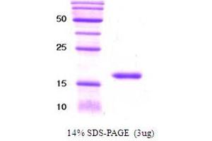 Killer Cell Immunoglobulin-Like Receptor, three Domains, Long Cytoplasmic Tail, 1 (KIR3DL1) (AA 361-444) protein (His tag)