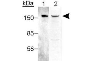 Western blot analysis of RAD50 in 25 ng purified hMre11-hRAD50 complex (Lane 1) and 25 ug crude HeLa extract (Lane 2 :) with RAD50 polyclonal antibody . (RAD50 antibody  (AA 628-787))