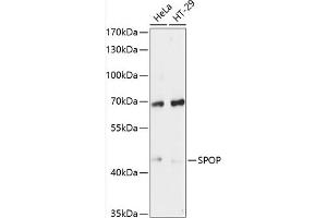 Western blot analysis of extracts of various cell lines, using SPOP antibody (ABIN6130702, ABIN6148373, ABIN6148375 and ABIN6215681) at 1:3000 dilution. (SPOP-B antibody  (AA 175-374))