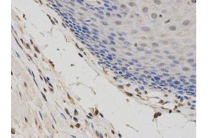 Immunohistochemistry (IHC) image for anti-Second Mitochondria-Derived Activator of Caspase (DIABLO) antibody (ABIN1872269) (DIABLO antibody)