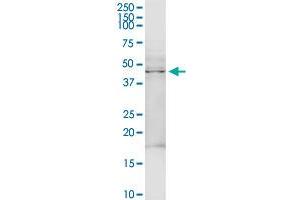TRDMT1 MaxPab rabbit polyclonal antibody.