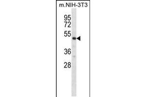 Western Blotting (WB) image for anti-Ribosomal Protein S6 Kinase, 70kDa, Polypeptide 2 (RPS6KB2) (AA 318-346), (C-Term) antibody (ABIN5531785)