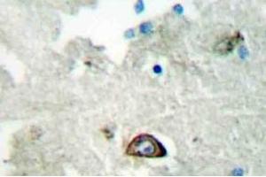 Immunohistochemistry (IHC) analyzes of Ephrin-A3 antibody in paraffin-embedded human brain tissue. (Ephrin A3 antibody)