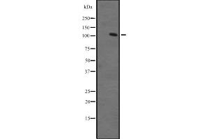 Western blot analysis of ZFPM1 expression in Ant fetal muscle lysate ;,The lane on the left is treated with the antigen-specific peptide.