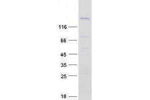 Proteasome (Prosome, Macropain) Activator Subunit 4 (PSME4) protein (Myc-DYKDDDDK Tag)