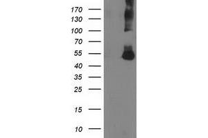 Image no. 1 for anti-Coronin, Actin Binding Protein, 1A (CORO1A) antibody (ABIN1497574) (Coronin 1a antibody)