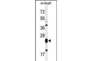 Western blot analysis of MLF1 Antibody in mouse heart tissue lysates (35ug/lane)