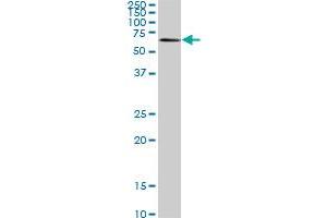 AKT3 monoclonal antibody (M07), clone 6F12. (AKT3 antibody  (AA 100-189))