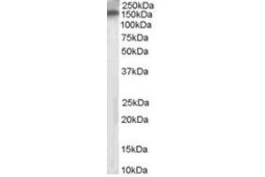 Image no. 1 for anti-Receptor Protein Tyrosine Phosphatase (PTPRT) (Internal Region) antibody (ABIN374470) (PTPRT antibody  (Internal Region))