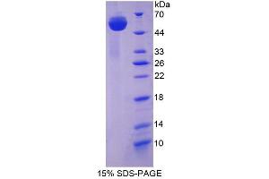 Image no. 1 for Huntingtin Associated Protein 1 (HAP1) (AA 160-381) protein (His tag,GST tag) (ABIN4990752) (HAP1 Protein (AA 160-381) (His tag,GST tag))