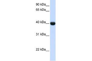 ADH1A antibody used at 1 ug/ml to detect target protein.