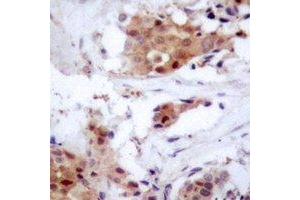 Immunohistochemistry (IHC) image for anti-Nucleoporin 62kDa (NUP62) antibody (ABIN7308108) (NUP62 antibody)