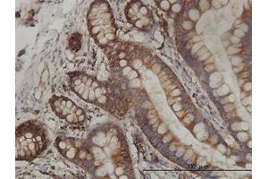 Image no. 2 for anti-Ribosomal Protein L19 (RPL19) (AA 1-101) antibody (ABIN465969) (RPL19 antibody  (AA 1-101))