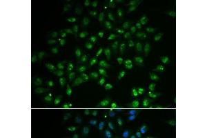 Immunofluorescence analysis of A549 cells using HAND2 Polyclonal Antibody (HAND2 antibody)