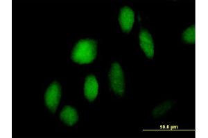 Immunofluorescence of purified MaxPab antibody to ZNF473 on HeLa cell. (ZNF473 antibody  (AA 1-871))