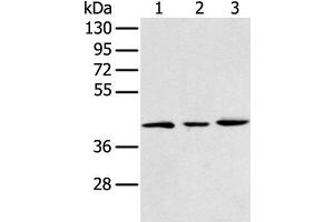 Western blot analysis of 293T K562 and Raji cell using DCX Polyclonal Antibody at dilution of 1:400 (Doublecortin antibody)