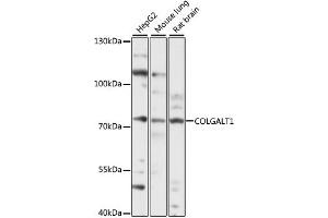 Western blot analysis of extracts of various cell lines, using COLG antibody (ABIN7267480) at 1:1000 dilution. (GLT25D1 antibody  (AA 30-230))